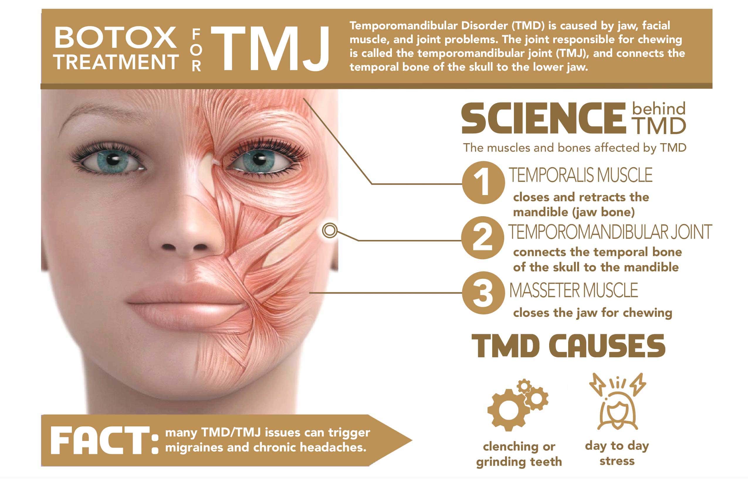 Botox TMJ Disorder Mechanism